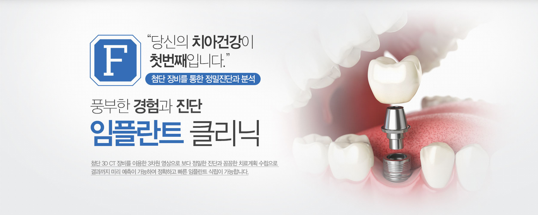 당신의 치아건강이 첫번째입니다. 풍부한 경험과 진단 임플란트 클리닉!